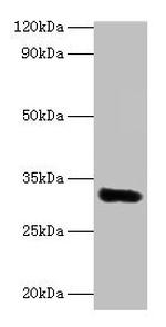 EEF1D Antibody in Western Blot (WB)