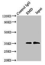 Emerin Antibody in Western Blot (WB)