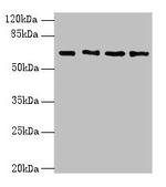 ENC1 Antibody in Western Blot (WB)