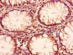 ENTPD8 Antibody in Immunohistochemistry (Paraffin) (IHC (P))