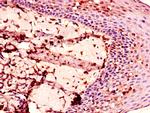 ENTPD8 Antibody in Immunohistochemistry (Paraffin) (IHC (P))