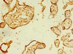 ERLIN1 Antibody in Immunohistochemistry (Paraffin) (IHC (P))