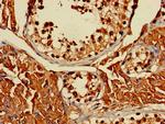 ERLIN1 Antibody in Immunohistochemistry (Paraffin) (IHC (P))