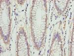 ERLIN2 Antibody in Immunohistochemistry (Paraffin) (IHC (P))