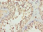 ERLIN2 Antibody in Immunohistochemistry (Paraffin) (IHC (P))