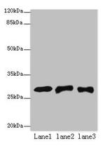 ETHE1 Antibody in Western Blot (WB)