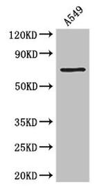 Prothrombin Antibody in Western Blot (WB)