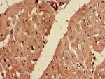 FADS1 Antibody in Immunohistochemistry (Paraffin) (IHC (P))