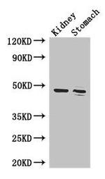 FAH Antibody in Western Blot (WB)