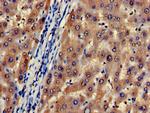 CDA Antibody in Immunohistochemistry (Paraffin) (IHC (P))