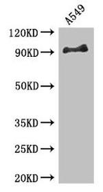 FGFR1 Antibody in Western Blot (WB)