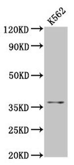 FGL1 Antibody in Western Blot (WB)