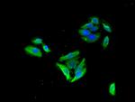 GABRB3 Antibody in Immunocytochemistry (ICC/IF)