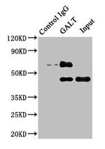 GALT Antibody in Western Blot (WB)