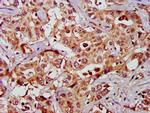 GAS2 Antibody in Immunohistochemistry (Paraffin) (IHC (P))