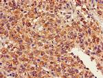 GDAP1L1 Antibody in Immunohistochemistry (Paraffin) (IHC (P))