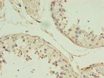 GIF Antibody in Immunohistochemistry (Paraffin) (IHC (P))