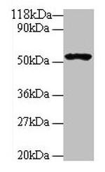 GLP1R Antibody in Western Blot (WB)