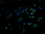 GLP1R Antibody in Immunocytochemistry (ICC/IF)