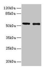 GLP1R Antibody in Western Blot (WB)