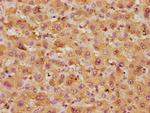 GOT1 Antibody in Immunohistochemistry (Paraffin) (IHC (P))