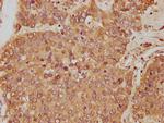 GOT1 Antibody in Immunohistochemistry (Paraffin) (IHC (P))