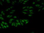 SNRPA Antibody in Immunocytochemistry (ICC/IF)