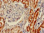 GPT Antibody in Immunohistochemistry (Paraffin) (IHC (P))