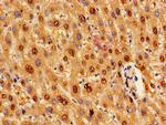 GPT Antibody in Immunohistochemistry (Paraffin) (IHC (P))