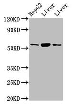 GPT Antibody in Western Blot (WB)