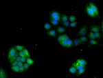 GRK4 Antibody in Immunocytochemistry (ICC/IF)