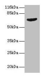 GRK4 Antibody in Western Blot (WB)