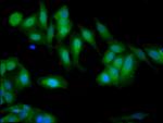 Gelsolin Antibody in Immunocytochemistry (ICC/IF)