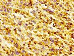 Gelsolin Antibody in Immunohistochemistry (Paraffin) (IHC (P))