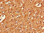 HARS2 Antibody in Immunohistochemistry (Paraffin) (IHC (P))