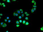 HK2 Antibody in Immunocytochemistry (ICC/IF)