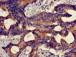 HMBS Antibody in Immunohistochemistry (Paraffin) (IHC (P))