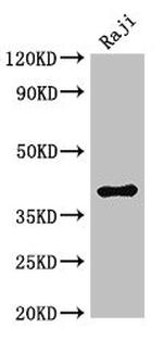 HMBS Antibody in Western Blot (WB)