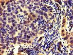 HMGCR Antibody in Immunohistochemistry (Paraffin) (IHC (P))