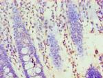 HOXA1 Antibody in Immunohistochemistry (Paraffin) (IHC (P))