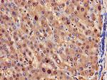 HPD Antibody in Immunohistochemistry (Paraffin) (IHC (P))