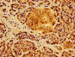 HS2ST1 Antibody in Immunohistochemistry (Paraffin) (IHC (P))