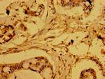 HTRA2 Antibody in Immunohistochemistry (Paraffin) (IHC (P))