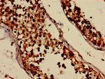 IFI44 Antibody in Immunohistochemistry (Paraffin) (IHC (P))