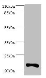 Interferon alpha-10 Antibody in Western Blot (WB)