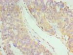 IFNAR2 Antibody in Immunohistochemistry (Paraffin) (IHC (P))