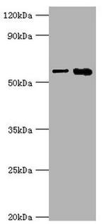 IL1R1 Antibody in Western Blot (WB)