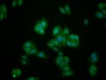 IL1RAPL1 Antibody in Immunocytochemistry (ICC/IF)