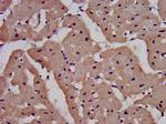 IL1RAPL1 Antibody in Immunohistochemistry (Paraffin) (IHC (P))