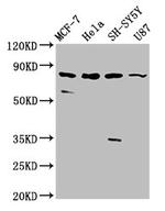 IL1RAPL1 Antibody in Western Blot (WB)